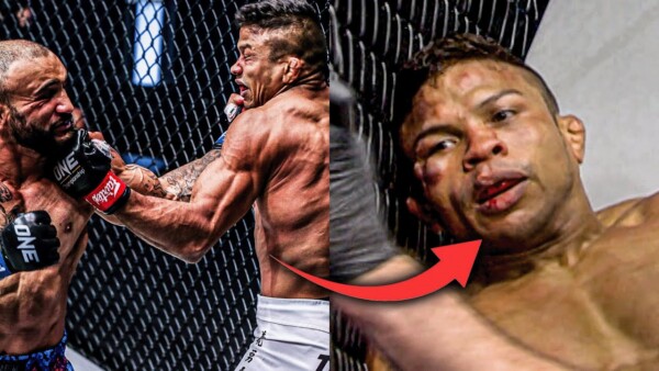 The Sound Of Those Shots  John Lineker Stunned Bibiano Fernandes