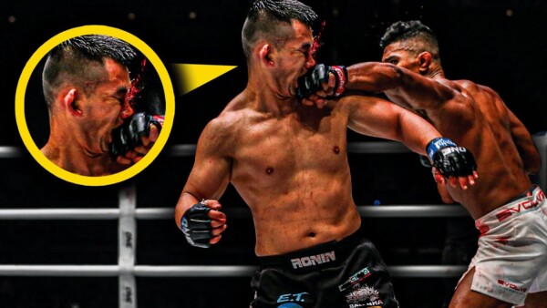 Razor Close MMA War  Amir Khan vs. Ev Ting