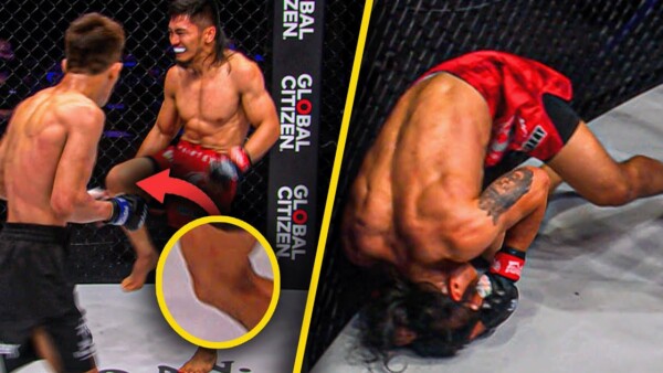 OUCH  The Unfortunate Ending To Jeremy Miado vs. Lito Adiwang