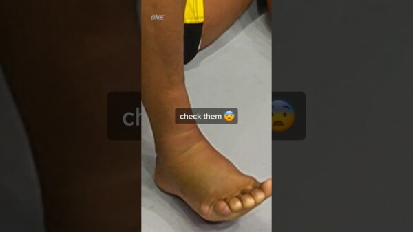 Ouch  How do you block those leg kicks? ⁠