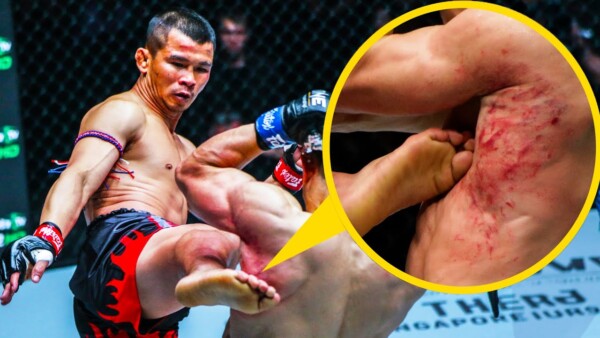 How Many Kicks Can You Take From Nong O ⁉️ Muay Thai Fight Highlight