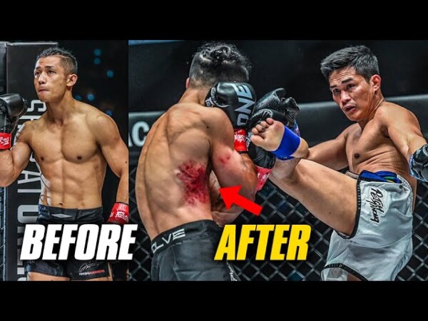 Nasty Strikes  Petchtanong vs. Hiroki Akimoto was HEATED!