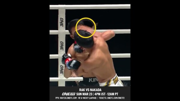 Elbow that left a mark