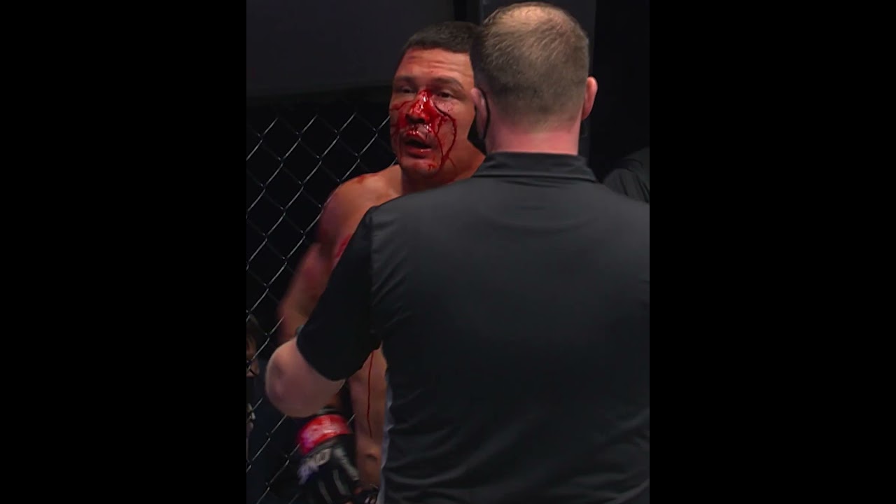 ABSOLUTE MAYHEM  Dagi Arslanaliev and Timofey Nastyukhin went ALL OUT in this insane MMA clash!
