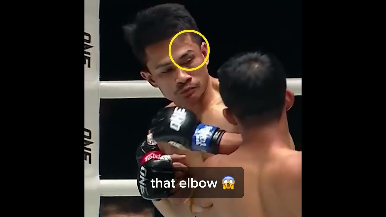 SAVAGE ELBOW